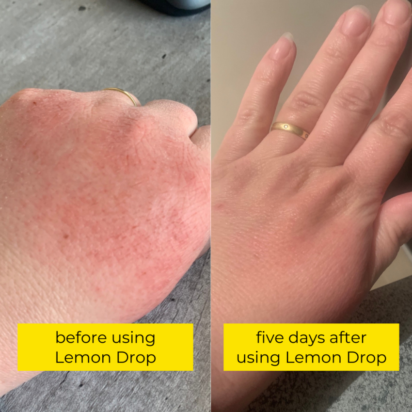 before and after using Bettyquette Lemon Drop, hand nail and cuticle oil